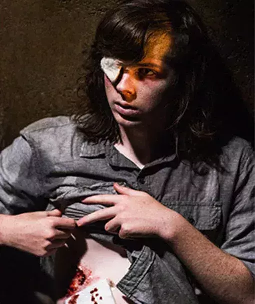 Carl est encore vivant dans les comics, mais la série a préféré en finir avec lui suite à une vilaine morsure !